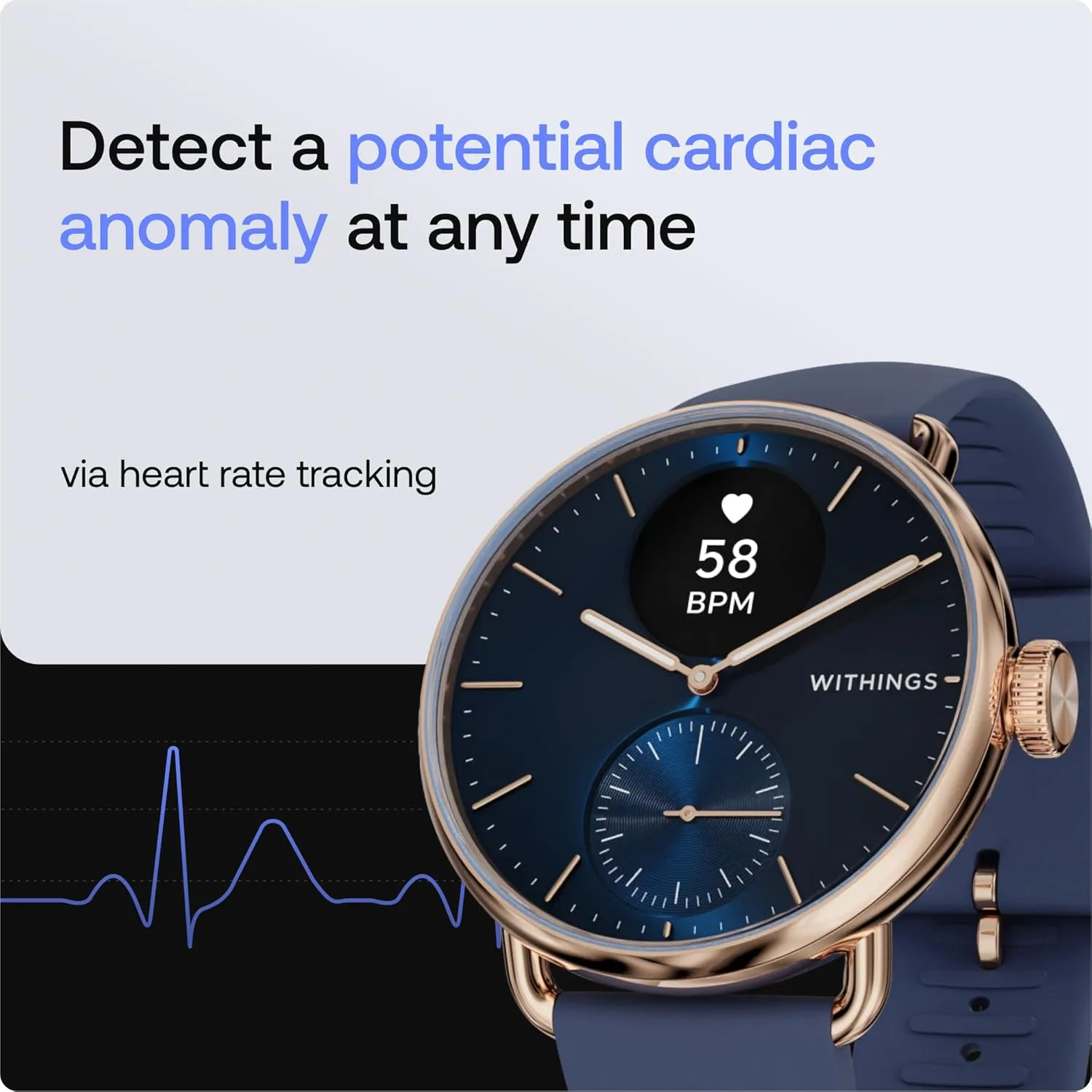 Hybrid Smart Watch, Heart Rate Monitoring, Fitness Tracker, Cycle Tracker, Sleep Monitoring, GPS Tracker, 30-Day Battery Life, Android & Apple Compatible, HSA/FSA Withings wreck criss-cross ScanWatch 2 - 
